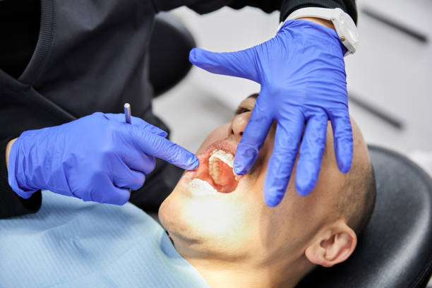 Best Emergency Wisdom Teeth Removal in Quinebaug, CT