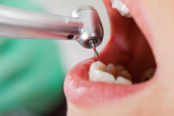 Best Pediatric Emergency Dentist in Quinebaug, CT